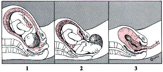 3 периода родов